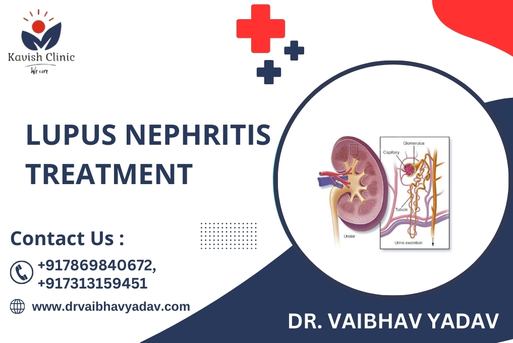 Lupus nephritis Treatment Specialist In Indore