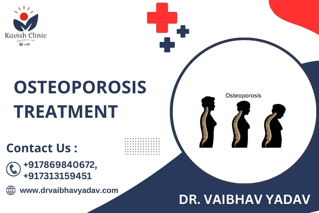 Osteoporosis Treatment in Indore