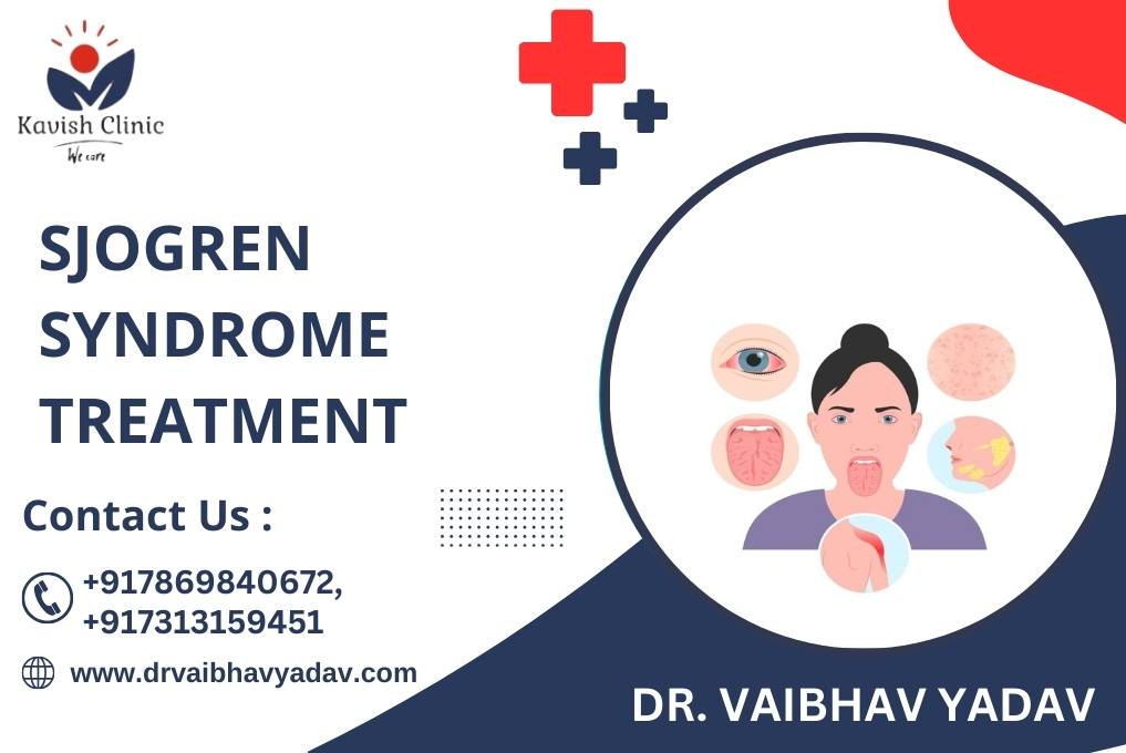 Sjogren Syndrome Treatment in Indore