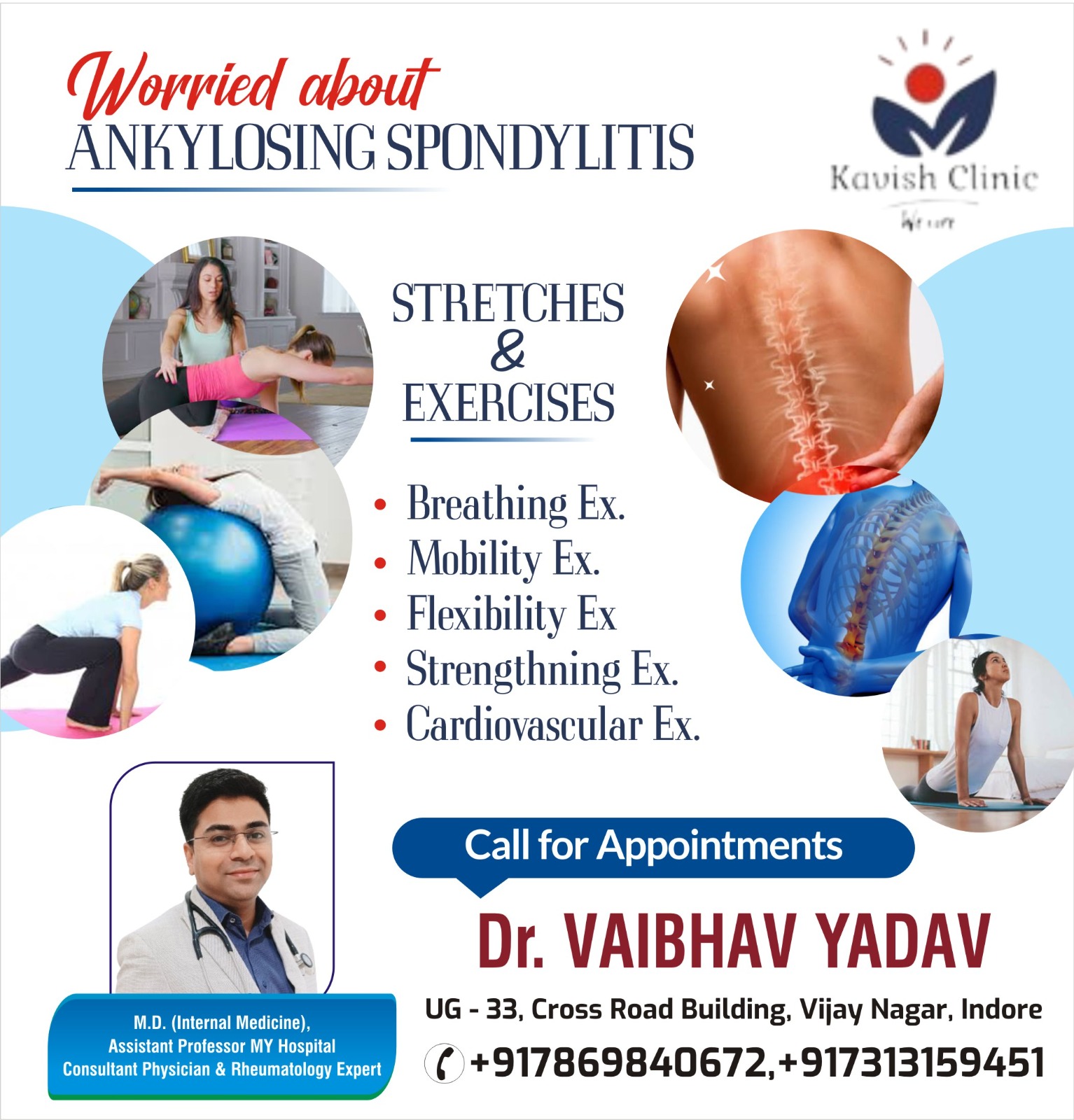 Best Doctor for Ankylosing Spondylitis in Indore