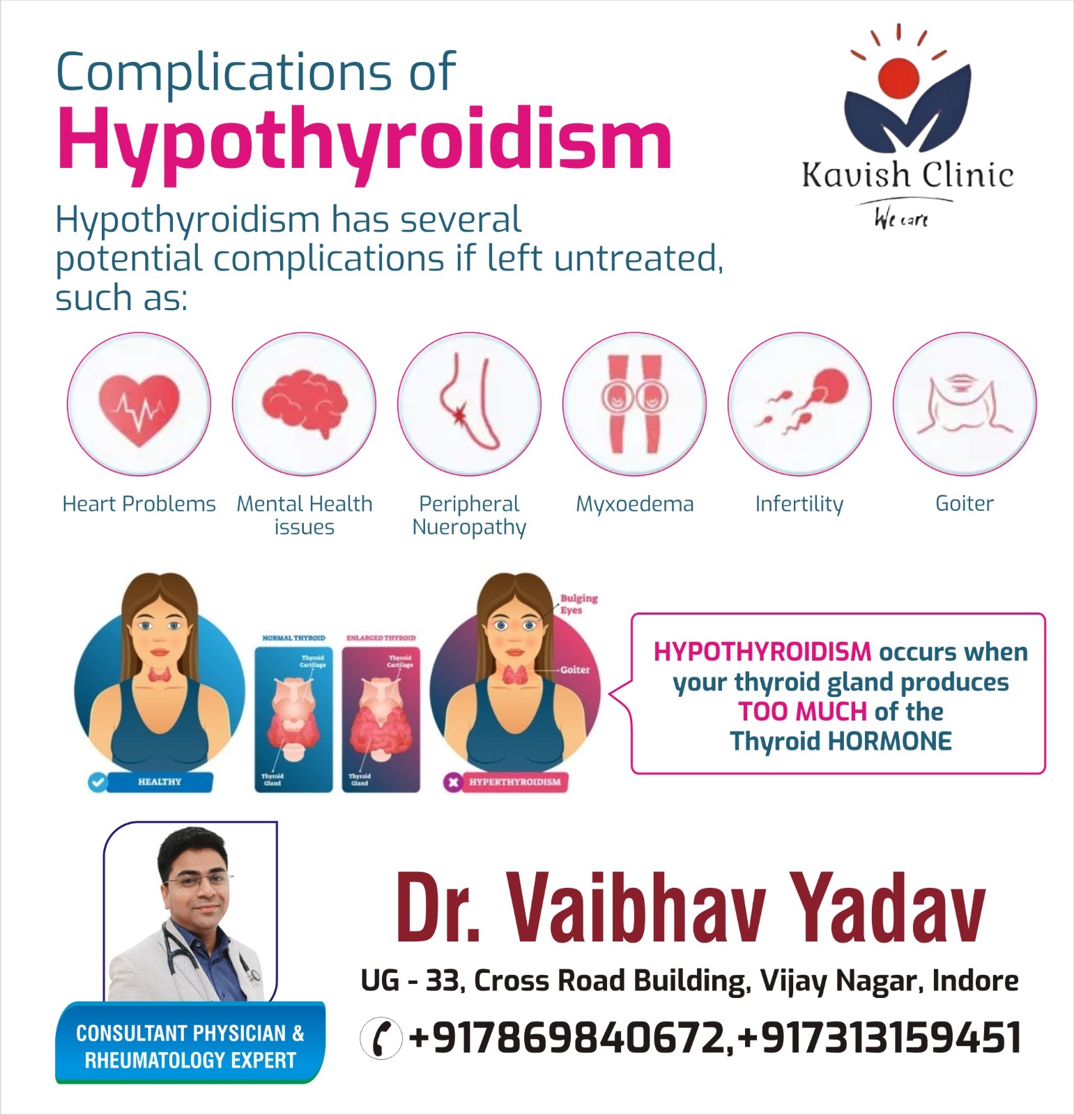 Top Doctor for Hypothyroidism Treatment in Indore