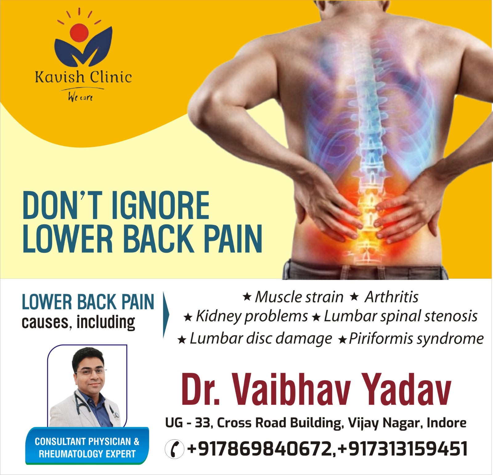 Best rheumatologist for Low Backache Treatment in Indore