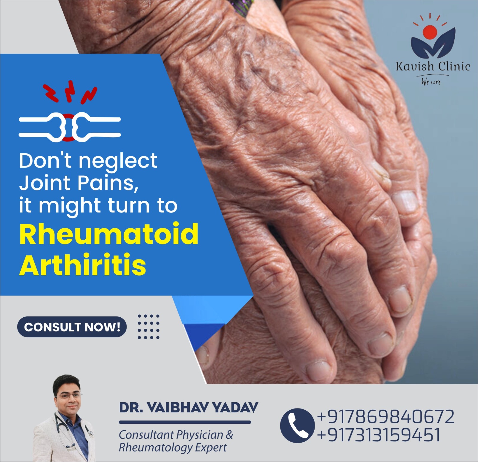 Best Rheumatologist Specialist for Rheumatoid Arthritis Treatment in Indore