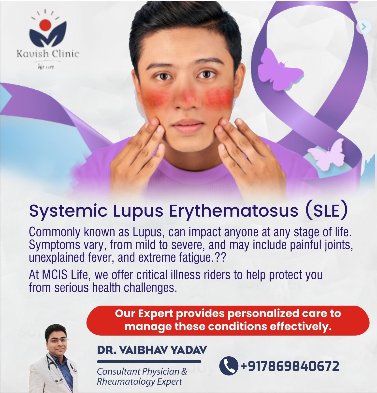 Best Doctor for SLE Treatment in Indore