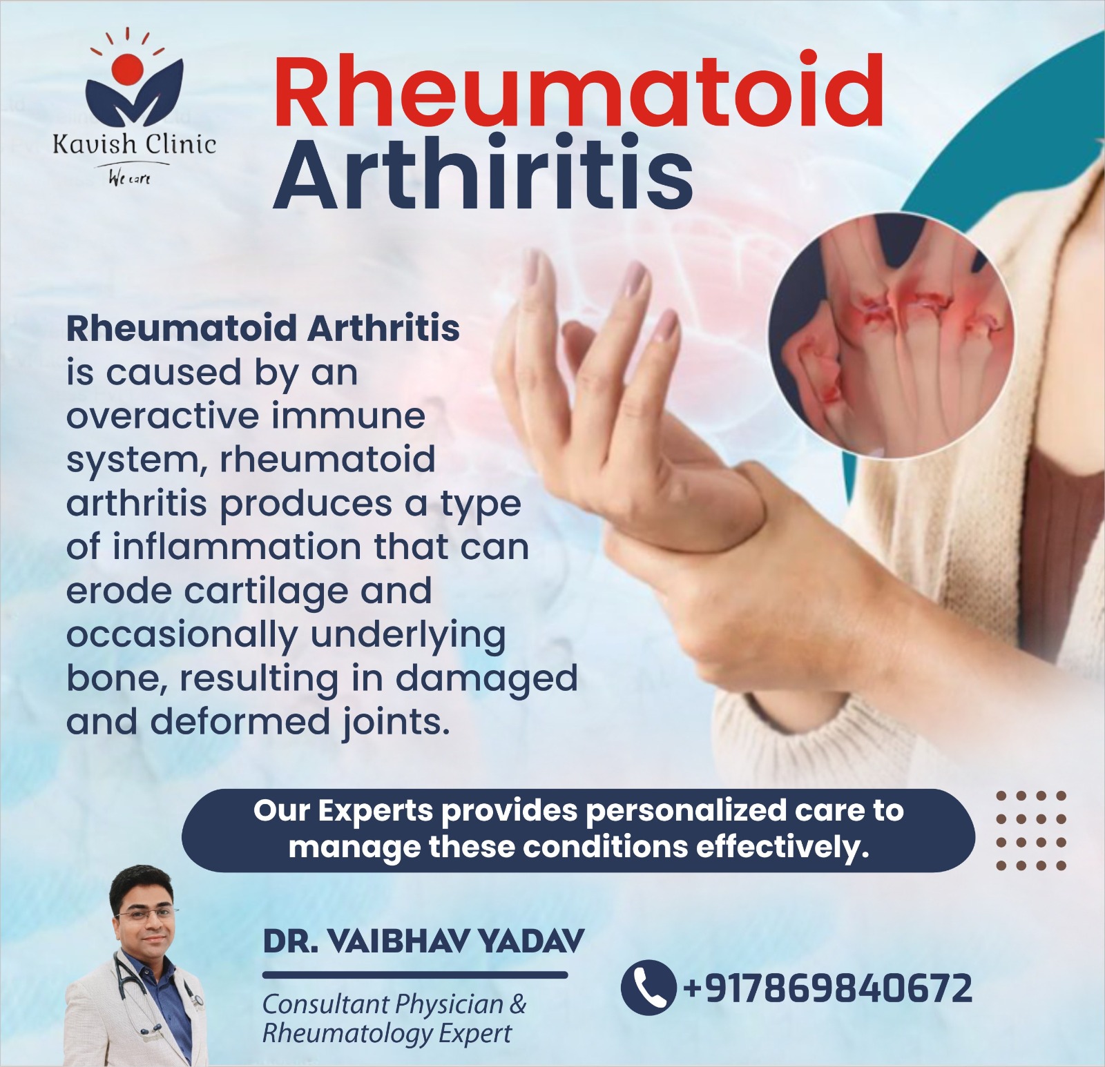 Best Rheumatologist in Indore