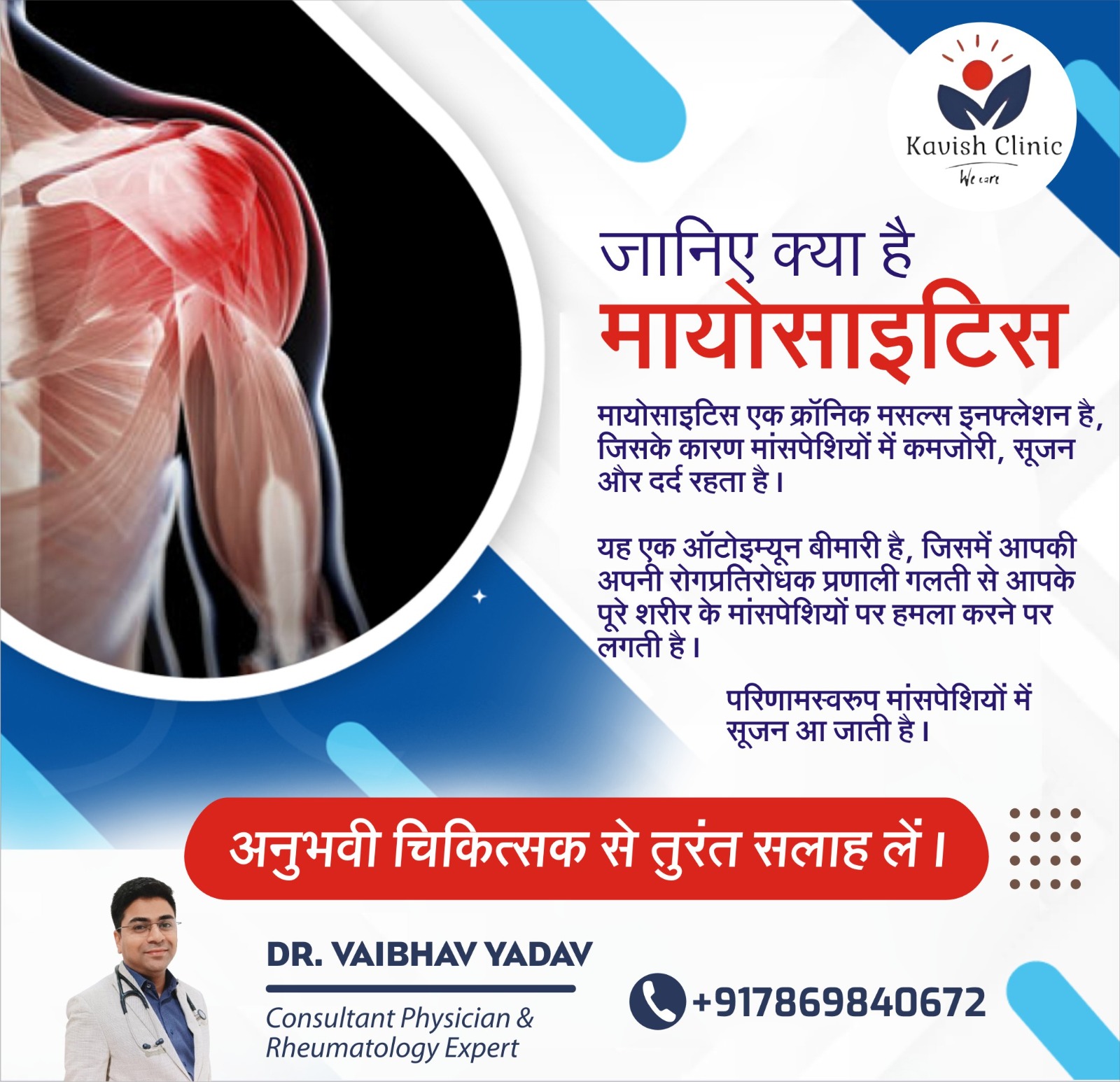 Best rheumatologist in Indore