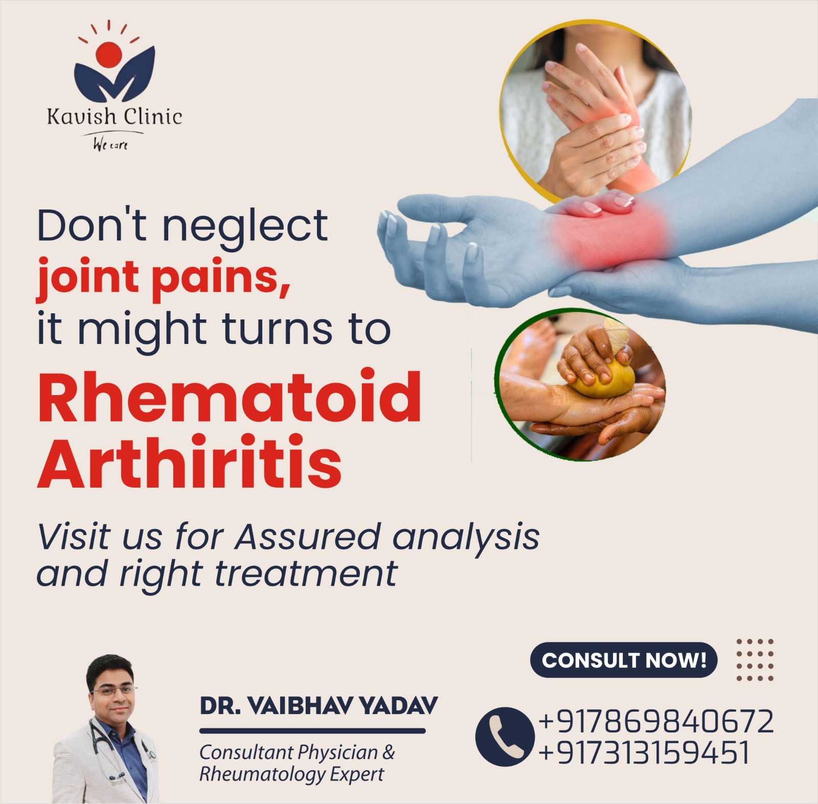 Best Doctor for Rheumatoid Arthritis Treatment in Indore