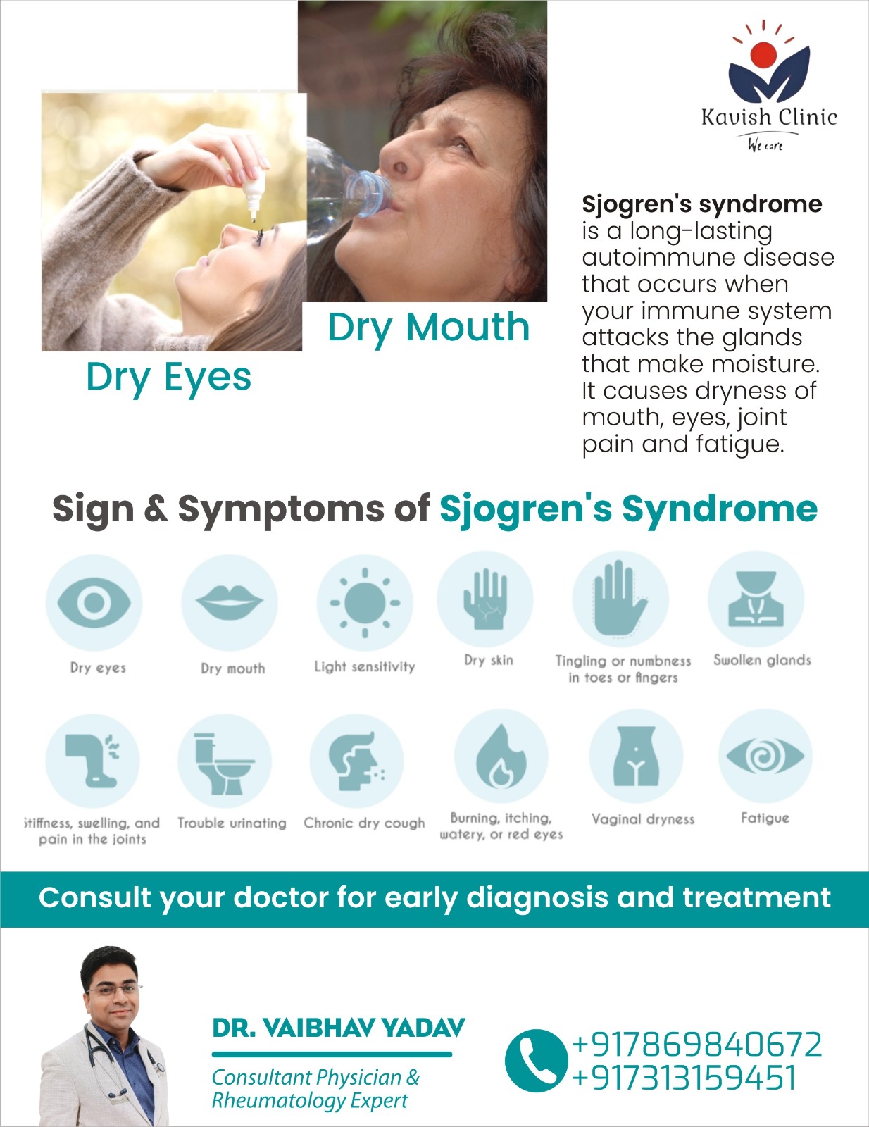 Best Doctor for Sjogrens Syndrome Treatment in Indore