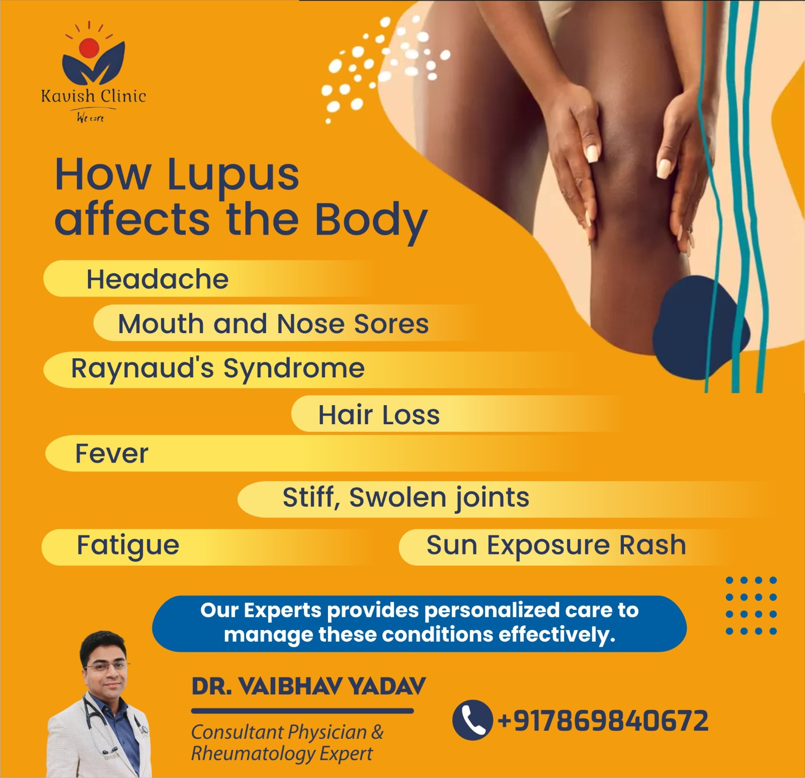 Best Lupus Nephritis Specialist in Indore