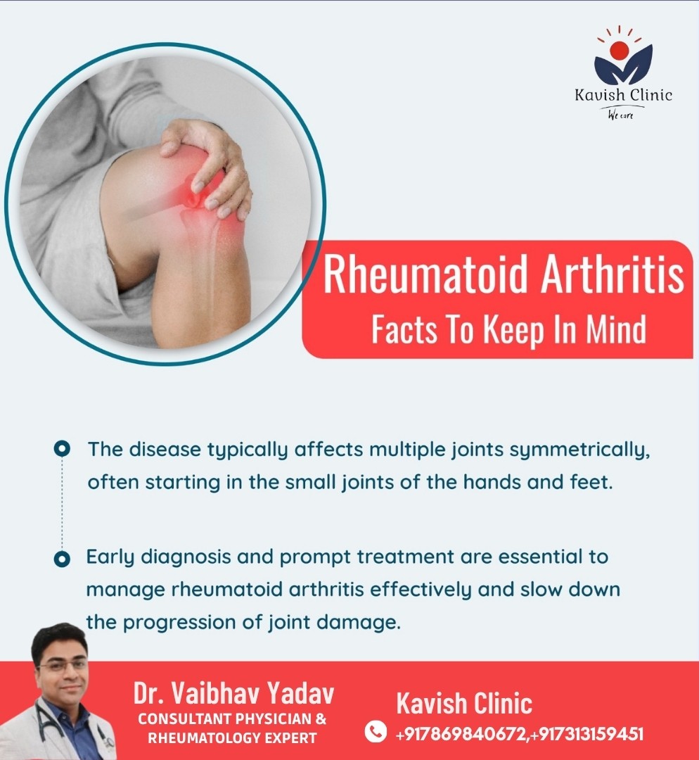 Best Rheumatologist in Indore