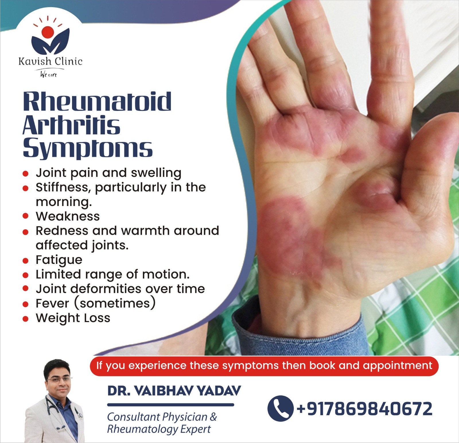 Best Rheumatologist in Indore