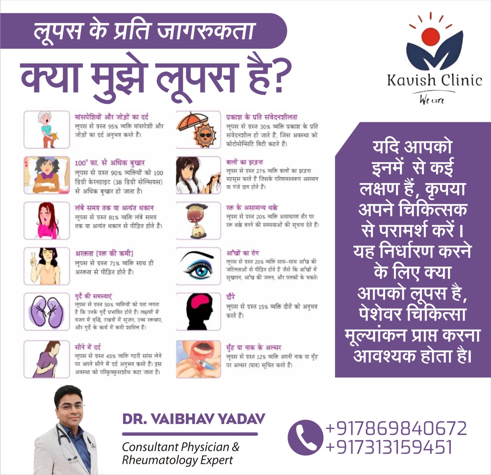 Lupus Treatment Specialist In Indore