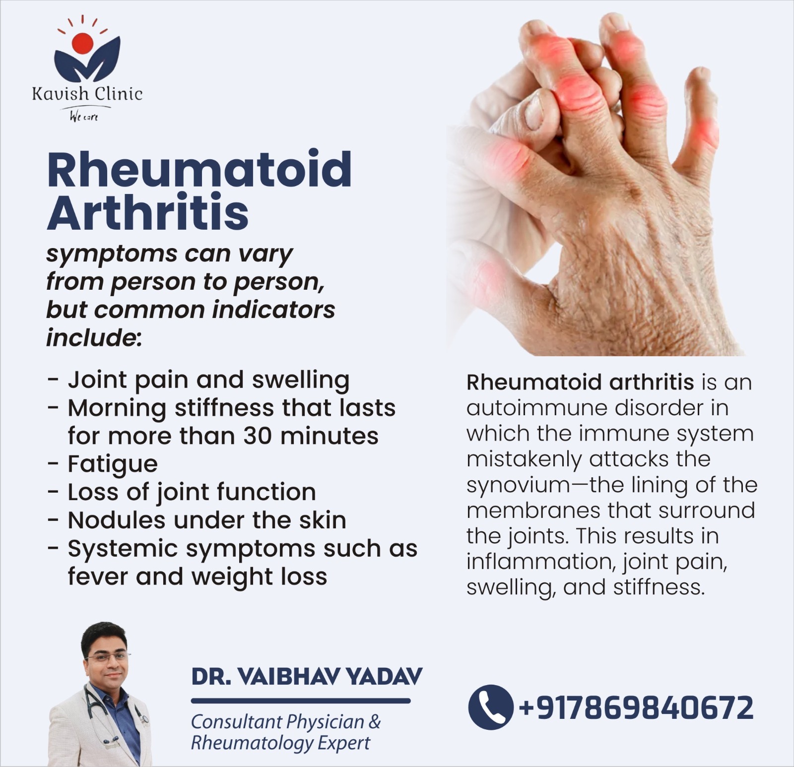 Top Rheumatologist in Indore