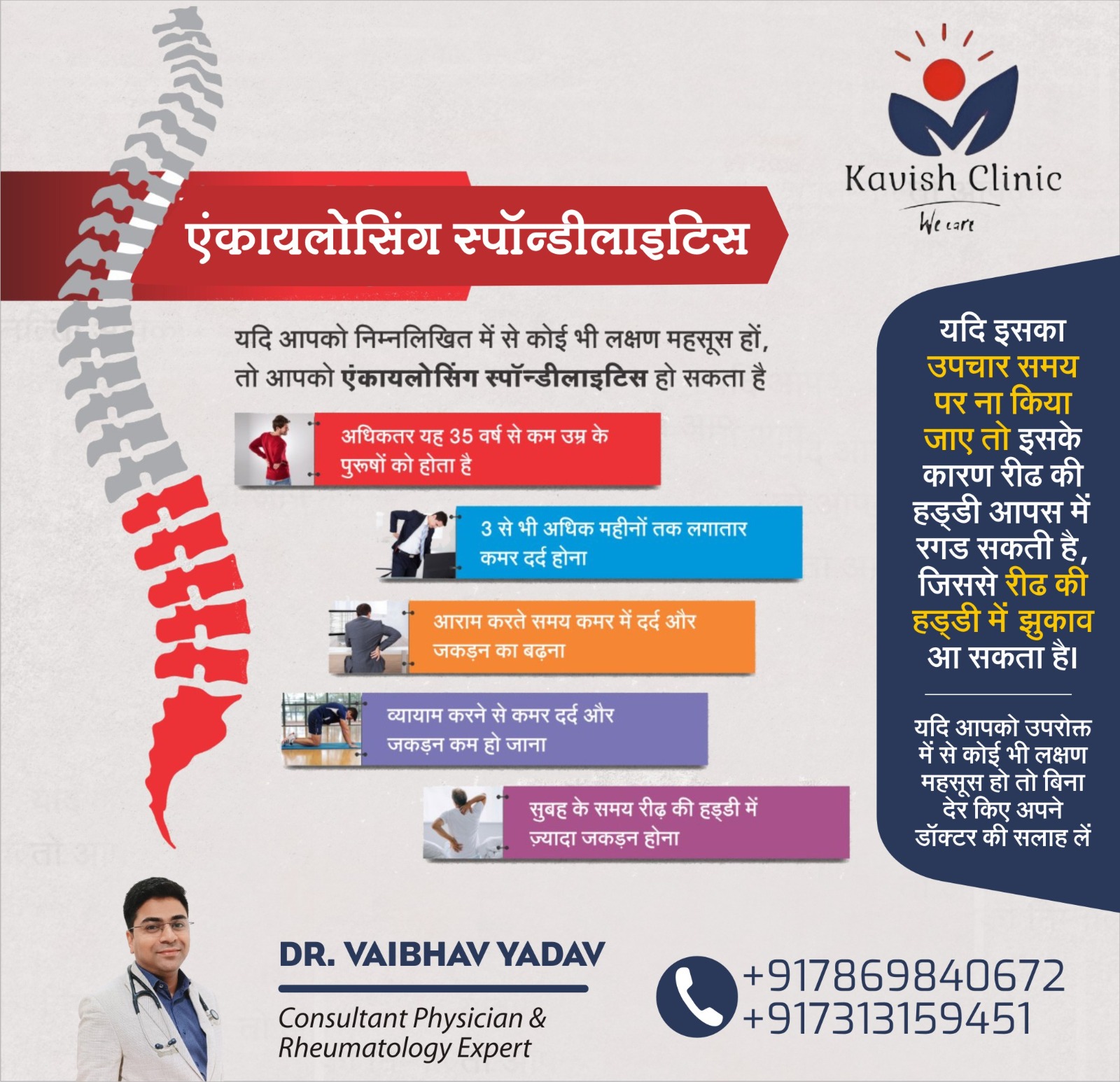 Rheumatologist For Ankylosing spondylitis Treatment in Indore