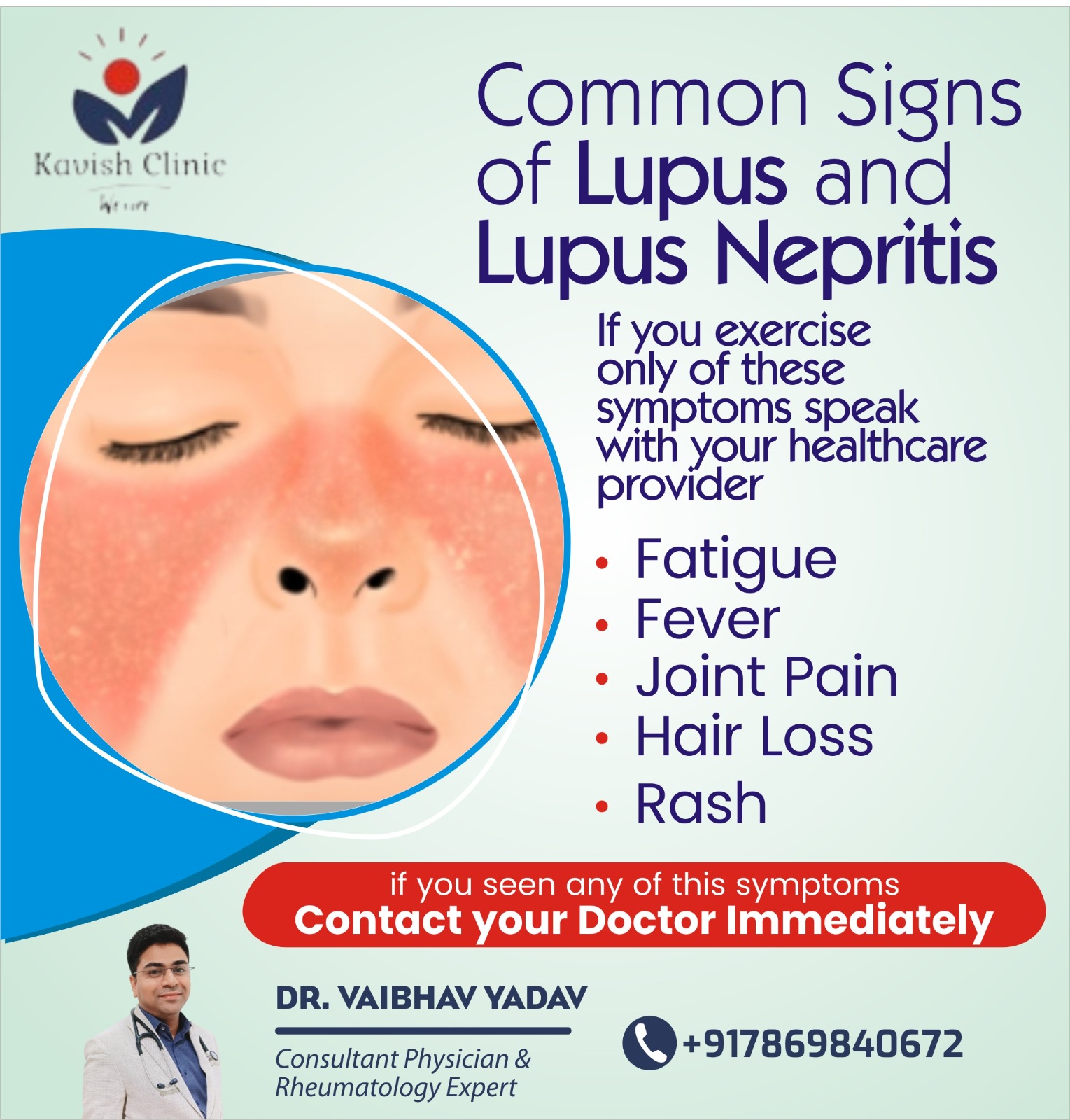 Best Doctor for Lupus Nephritis Treatment in Indore