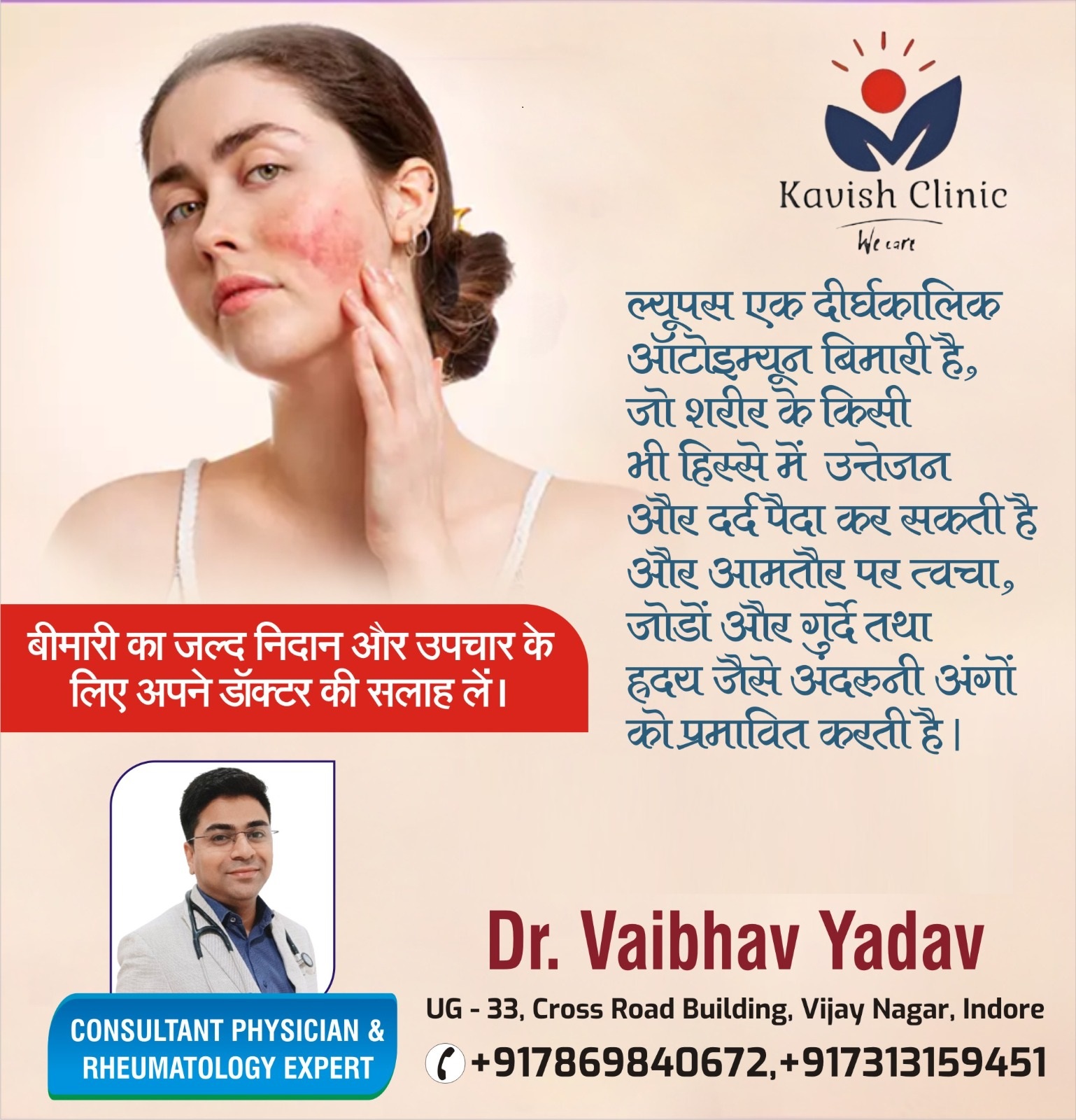 lupus nephritis Treatment In Indore